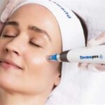 5 Alasan Harga Dermapen di ERHA Bikin Kantong Gemetar (Tapi Worth It!)