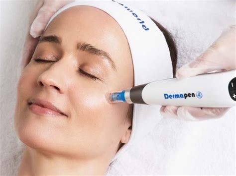 5 Alasan Harga Dermapen di ERHA Bikin Kantong Gemetar (Tapi Worth It!)