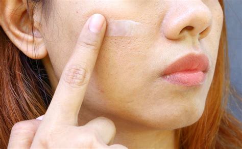 5 Alasan Laser Mengecilkan Pori-Pori Wajah Lebih Ampuh dari Skincare!