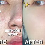 5 Cara Ampuh Agar Pori-Pori Tertutup Permanen!