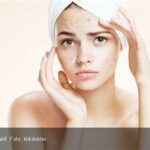 5 Cara Ampuh Merawat Kulit Sensitif: Goodbye Iritasi!