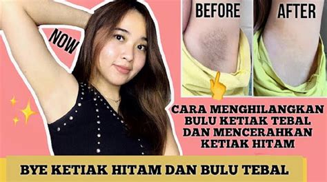 5 Cara Ampuh Perawatan Memutihkan Ketiak dalam 7 Hari 5 Cara Ampuh Perawatan Memutihkan Ketiak dalam 7 Hari