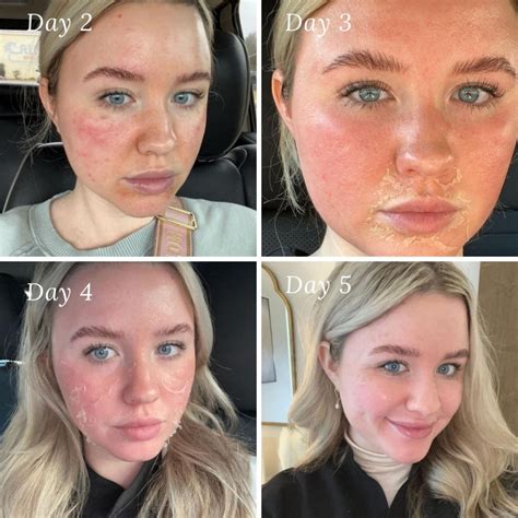 5 Facial Anti-Aging Di Bawah Rp500.000! 😱