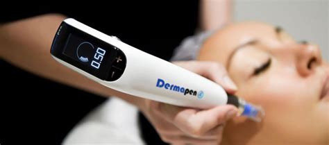 5 Fakta Harga Dermapen di Erha: Mulai dari Rp X Juta? 5 Fakta Harga Dermapen di Erha: Mulai dari Rp X Juta?
