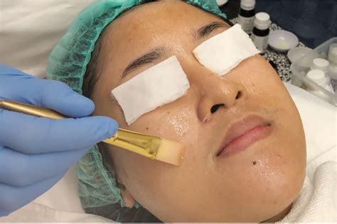 5 Fakta Peeling Naavagreen yang Bikin Kulit Glowing dalam Seminggu! 5 Fakta Peeling Naavagreen yang Bikin Kulit Glowing dalam Seminggu!