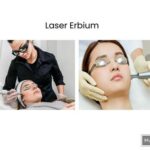 5 Harga Laser Wajah di Larissa yang Bikin Kamu Terkejut, Mulai dari Rp 500 Ribu!