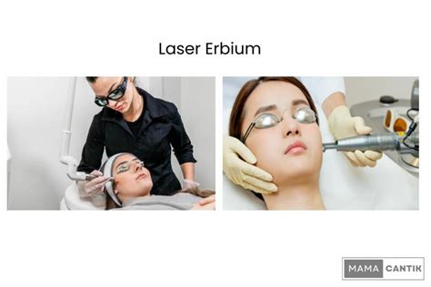 5 Harga Laser Wajah di Larissa yang Bikin Kamu Terkejut, Mulai dari Rp 500 Ribu!