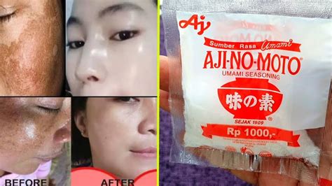 5 Manfaat Ajaib Ajinomoto untuk Wajah Glowing: Gak Percaya? 5 Manfaat Ajaib Ajinomoto untuk Wajah Glowing: Gak Percaya?