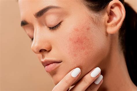 5 Manfaat Ajaib Ajinomoto untuk Wajah Glowing: Gak Percaya? 5 Manfaat Ajaib Ajinomoto untuk Wajah Glowing: Gak Percaya?