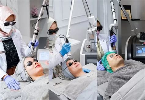 5 Perawatan Bening's Clinic di Bawah Rp. 200.000! Wajah Cantik Meriah Likup Desa ✨🤩 5 Perawatan Bening's Clinic di Bawah Rp. 200.000! Wajah Cantik Meriah Likup Desa ✨🤩