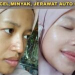 5 Pilihan Facial Larissa Harga Mulai 50 Ribuan: Bye-Bye Kulit Kusam!