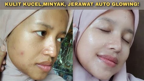 5 Pilihan Facial Larissa Harga Mulai 50 Ribuan: Bye-Bye Kulit Kusam!