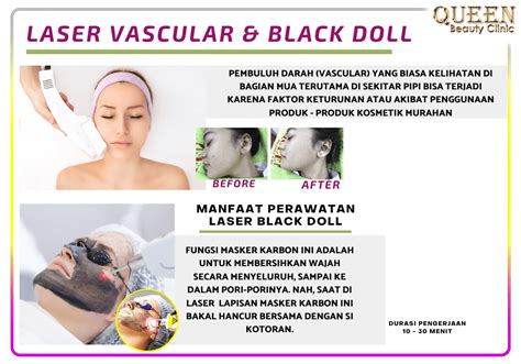 5 Rekomendasi Laser Wajah di Larissa, Mulai dari Rp500.000! 5 Rekomendasi Laser Wajah di Larissa, Mulai dari Rp500.000!