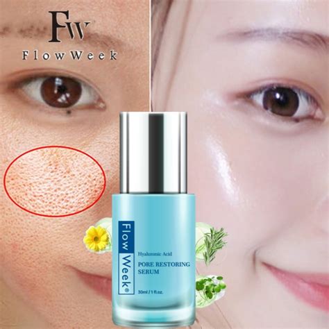 5 Serum Kehidupan yang Bisa Kecilkan Pori-Pori dalam Hitungan Minggu! 5 Serum Kehidupan yang Bisa Kecilkan Pori-Pori dalam Hitungan Minggu!