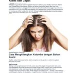 7 Cara Alami Menghilangkan Kulit Kepala Gatal dalam 3 Hari, Coba Sekarang!
