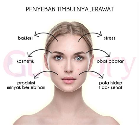 7 Cara Merawat Kulit Berjerawat dan Berminyak yang Ampuh dan Alami untuk Dicoba Sekarang! 7 Cara Merawat Kulit Berjerawat dan Berminyak yang Ampuh dan Alami untuk Dicoba Sekarang!