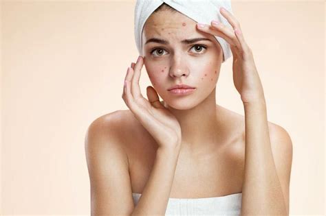 7 Cara Merawat Wajah yang Sensitif untuk Menghilangkan Kemerahan dan Iritasi dalam Semalam! 7 Cara Merawat Wajah yang Sensitif untuk Menghilangkan Kemerahan dan Iritasi dalam Semalam!