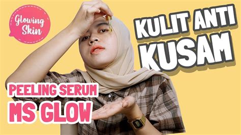 7 Harga Peeling Wajah MS Glow yang Bikin Kamu Mulus Maksimal Mulai dari Rp 50.000! 7 Harga Peeling Wajah MS Glow yang Bikin Kamu Mulus Maksimal Mulai dari Rp 50.000!