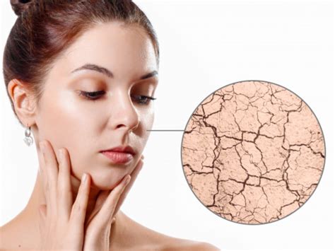 7 Jurus Ampuh Atasi Kulit Wajah Kering and Kusam Jadi Glowing! 7 Jurus Ampuh Atasi Kulit Wajah Kering and Kusam Jadi Glowing!
