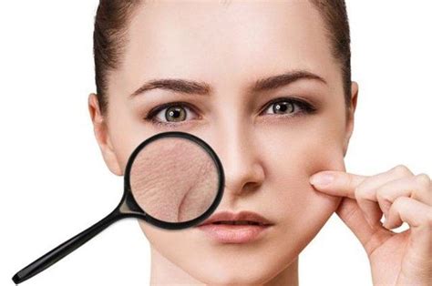 7 Jurus Ampuh Atasi Kulit Wajah Kering and Kusam Jadi Glowing! 7 Jurus Ampuh Atasi Kulit Wajah Kering and Kusam Jadi Glowing!