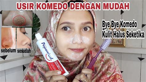 7 Jurus Ampuh Basmi Komedo Membandel, Wajah Mulus Seketika! 7 Jurus Ampuh Basmi Komedo Membandel, Wajah Mulus Seketika!