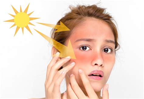 7 Langkah Rahasia Kulit Tetap Glowing Setelah Seharian Kena Matahari! 7 Langkah Rahasia Kulit Tetap Glowing Setelah Seharian Kena Matahari!