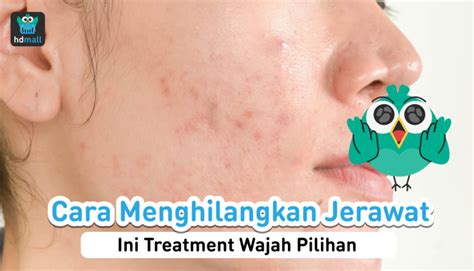 7 Manfaat Laser Wajah yang Bikin Glowing Permanen! 7 Manfaat Laser Wajah yang Bikin Glowing Permanen!