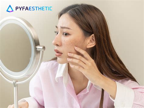 7 Manfaat Laser Wajah yang Bikin Glowing Permanen! 7 Manfaat Laser Wajah yang Bikin Glowing Permanen!