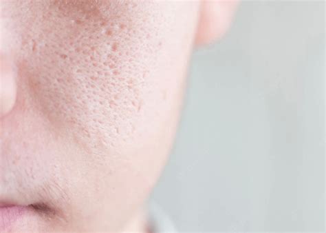 7 Manfaat Laser Wajah yang Bikin Glowing Permanen! 7 Manfaat Laser Wajah yang Bikin Glowing Permanen!