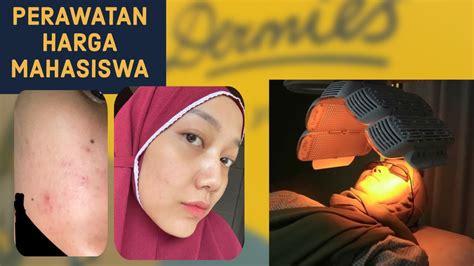 7 Perawatan di Dermies dengan Harga Mulai Rp500 Ribu yang Bisa Mengubah Wajahmu! 7 Perawatan di Dermies dengan Harga Mulai Rp500 Ribu yang Bisa Mengubah Wajahmu!