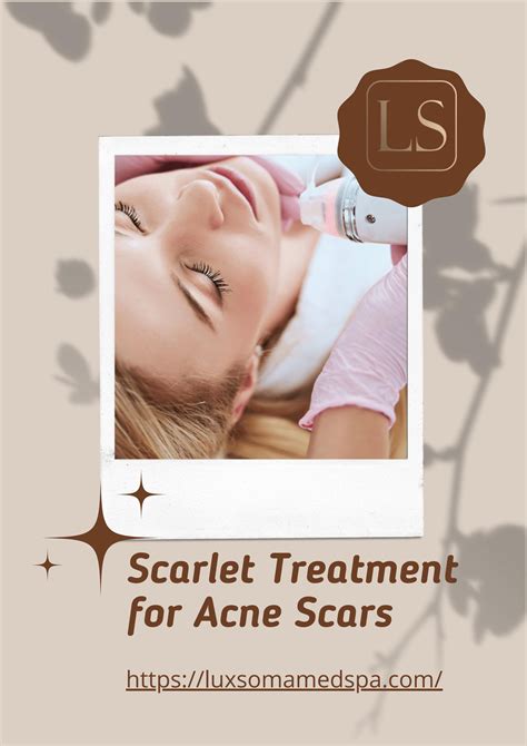 7 Perbandingan Harga Treatment Scarlett: Mana yang Paling Worth It di Kantongmu? 7 Perbandingan Harga Treatment Scarlett: Mana yang Paling Worth It di Kantongmu?