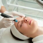 7 Perubahan Wajah yang Akan Terjadi Setelah Laser Wajah yang Perlu Kamu Tahu!