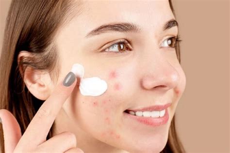 7 Rahasia Kulit Bebas Jerawat and Minyak: Bye-Bye Kilap, Hello Glowing! 7 Rahasia Kulit Bebas Jerawat and Minyak: Bye-Bye Kilap, Hello Glowing!
