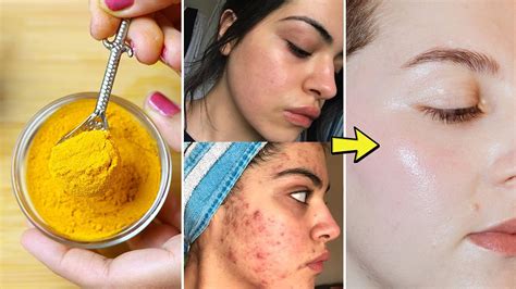 7 Rahasia Kulit Glowing Alami: Cuma Modal Bahan Dapur!