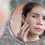7 Rahasia Kulit Kering Jadi Glowing, Bye-Bye Kusam!