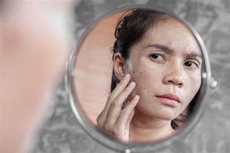 7 Rahasia Kulit Kering Jadi Glowing, Bye-Bye Kusam!