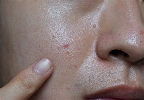 7 Rahasia Kulit Muka Kering Jadi Glowing Bebas Kusam! 7 Rahasia Kulit Muka Kering Jadi Glowing Bebas Kusam!