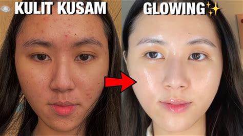 7 Rahasia Kulit Muka Kering Jadi Glowing Bebas Kusam!