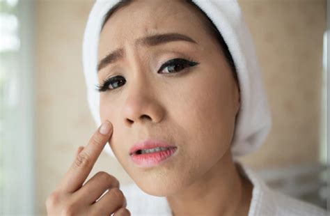 7 Rahasia Kulit Mulus Bebas Tekstur: Bye-Bye Bruntusan! 7 Rahasia Kulit Mulus Bebas Tekstur: Bye-Bye Bruntusan!