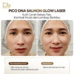 7 Rahasia Kulit Mulus Setelah Pico Laser: Bye-Bye Noda, Halo Glowing!