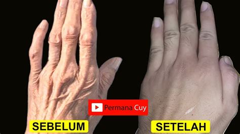 7 Rahasia Kulit Tangan Awet Muda Bebas Keriput! 7 Rahasia Kulit Tangan Awet Muda Bebas Keriput!
