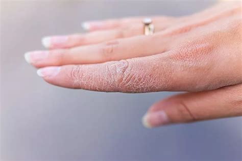 7 Rahasia Kulit Tangan Awet Muda Bebas Keriput! 7 Rahasia Kulit Tangan Awet Muda Bebas Keriput!