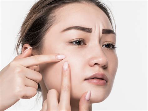 7 Rahasia Merawat Kulit Sensitif: Bye-Bye Kemerahan and Iritasi! 7 Rahasia Merawat Kulit Sensitif: Bye-Bye Kemerahan and Iritasi!