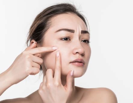7 Rahasia Wajah Mulus Bebas Jerawat: Cara Alami and Terbukti! 7 Rahasia Wajah Mulus Bebas Jerawat: Cara Alami and Terbukti!