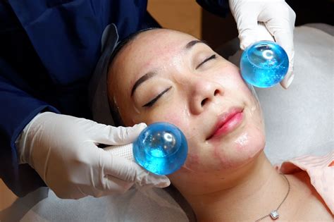 7 Treatment di Dermies yang Harganya Nggak Bikin Dompet Nangis (Mulai 50 Ribuan!)