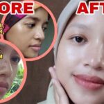 7 Treatment Larissa di Bawah 50 Ribu! Rahasia Glowing Tanpa Bokek!