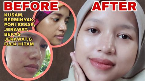 7 Treatment Larissa di Bawah 50 Ribu! Rahasia Glowing Tanpa Bokek!