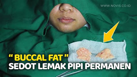 7 Treatment Mengecilkan Pipi Tembem, Hasilnya Bikin Pangling!