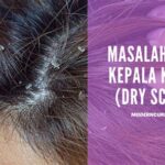 7 Cara Ampuh Mengatasi Kulit Kepala Kering and Gatal, Bye Ketombe!