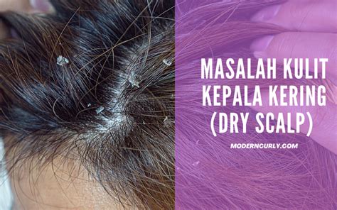 7 Cara Ampuh Mengatasi Kulit Kepala Kering and Gatal, Bye Ketombe!